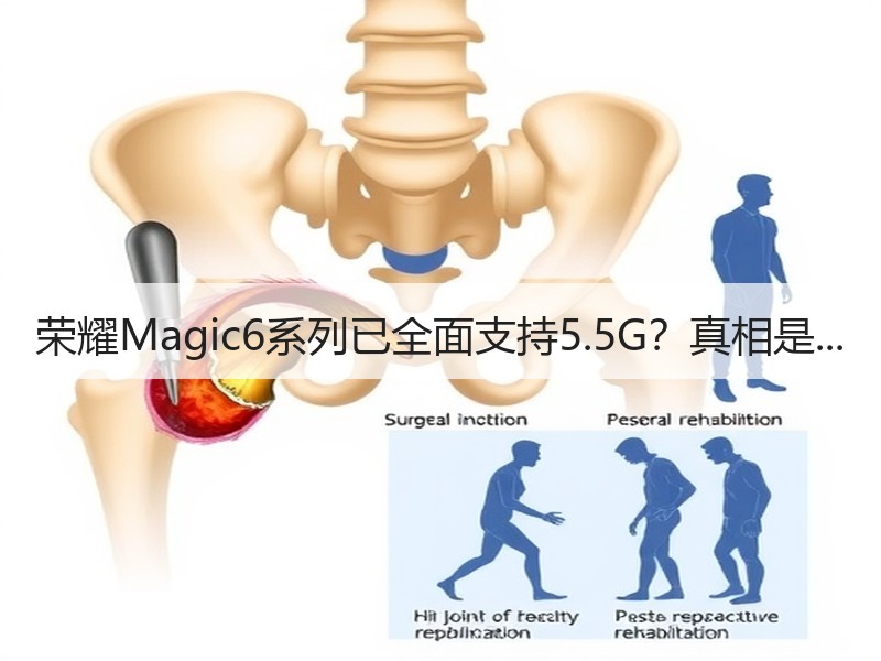 荣耀Magic6系列已全面支持5.5G？
